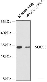 Immunofluorescence analysis of C6 cells using GOLGA4 Polyclonal Antibody at dilution of 1:100 (40x lens). Blue: DAPI for nuclear staining.