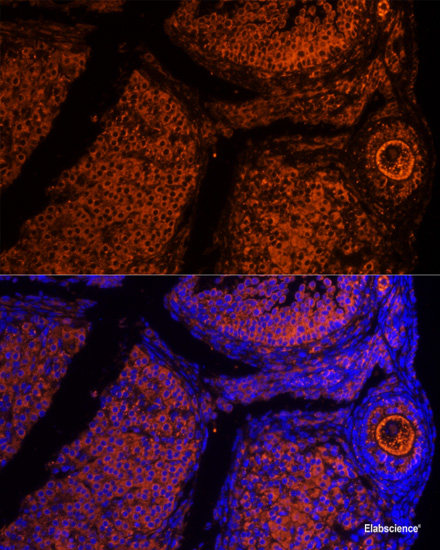 Immunohistochemistry of paraffin-embedded Rat brain using PRMT1 Polyclonal Antibody at dilution of 1:100 (40x lens).