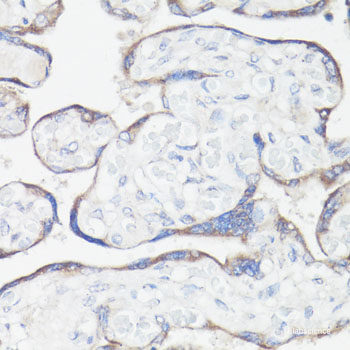 Immunohistochemistry of paraffin-embedded Human colon using MCM2 Polyclonal Antibody at dilution of 1:200 (40x lens).