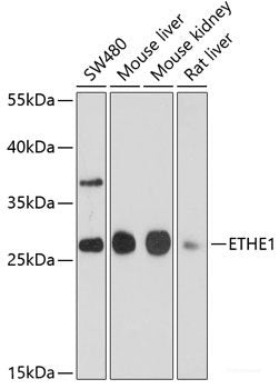 Immunohistochemistry of paraffin-embedded Rat brain using Slug Polyclonal Antibody at dilution of 1:100 (40x lens).