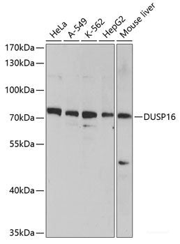 Western blot analysis of extracts of various cell lines using PARG Polyclonal Antibody at dilution of 1:7000.
