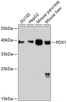 Immunofluorescence analysis of HeLa cells using PPP3CA Polyclonal Antibody