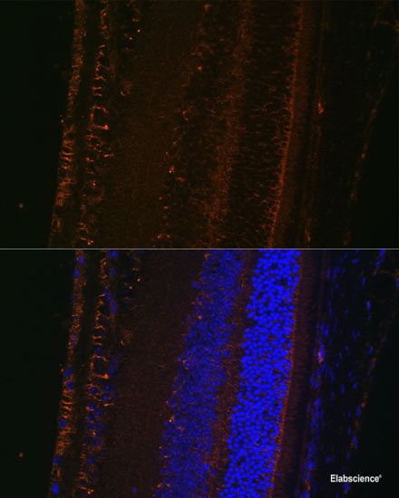 Immunohistochemistry of paraffin-embedded Human tonsil using CYBA Polyclonal Antibody at dilution of 1:100 (40x lens).