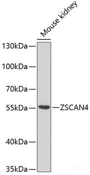 Immunofluorescence analysis of U2OS cells using HNRNPDL Polyclonal Antibody at dilution of 1:100. Blue: DAPI for nuclear staining.