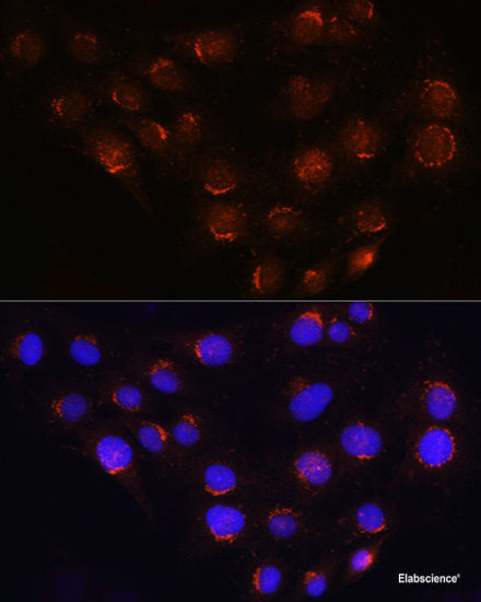 Immunohistochemistry of paraffin-embedded Rat spinal cord using HADH Polyclonal Antibody at dilution of 1:100 (40x lens).