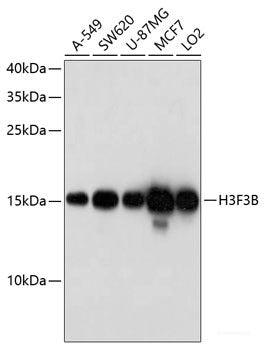 Immunohistochemistry of paraffin-embedded Human prostate using CUL3 Polyclonal Antibody at dilution of 1:100 (40x lens).