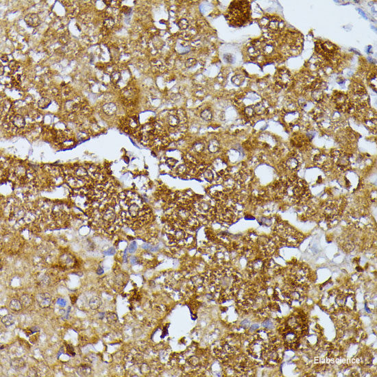 Immunohistochemistry of paraffin-embedded Mouse brain using ALPL Polyclonal Antibody at dilution of 1:100 (40x lens).