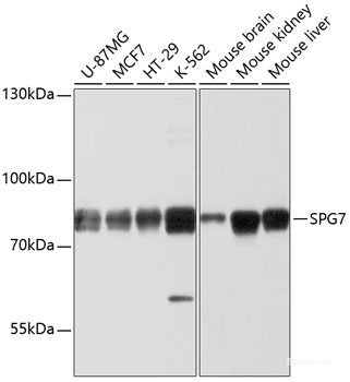 Immunohistochemistry of paraffin-embedded Human colon using FAM3B Polyclonal Antibody at dilution of 1:100 (40x lens).