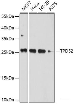 Western blot analysis of extracts of HeLa cells using DES Polyclonal Antibody.