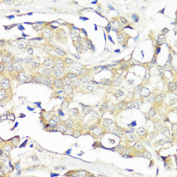 Immunohistochemistry of paraffin-embedded Human placenta using HSD17B1 Polyclonal Antibody at dilution of 1:100 (40x lens).