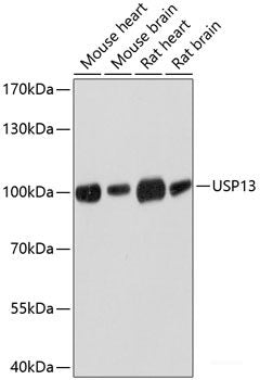 Immunohistochemistry of paraffin-embedded Human stomach using PDIA3 Polyclonal Antibody at dilution of 1:100 (40x lens).