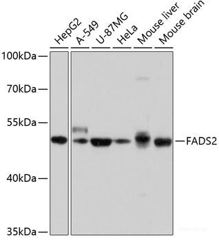 Western blot analysis of extracts of various cell lines using CSF1 Polyclonal Antibody at dilution of 1:1000.