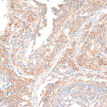 Immunohistochemistry of paraffin-embedded Human prostate using RNASE11 Polyclonal Antibody at dilution of 1:100 (40x lens).