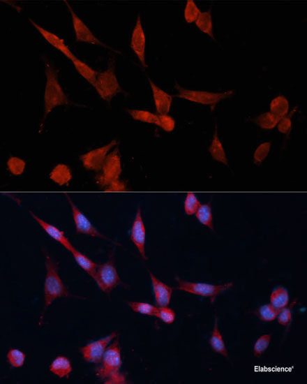 Western blot analysis of extracts of various cell lines using IL22RA1 Polyclonal Antibody at dilution of 1:1000.