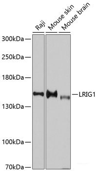 Western blot analysis of extracts of THP-1 cells using TNFR2 Polyclonal Antibody at dilution of 1:1000.