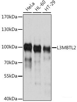 Immunofluorescence analysis of C6 cells using BRCA1 Polyclonal Antibody at dilution of 1:100. Blue: DAPI for nuclear staining.