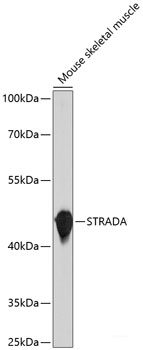 Immunohistochemistry of paraffin-embedded Human kidney cancer using BAG1 Polyclonal Antibody at dilution of 1:100 (40x lens).