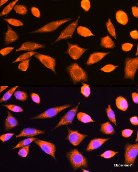 Western blot analysis of extracts from normal (control) and EZH2 knockout (KO) HeLa cells using EZH2 Polyclonal Antibody at dilution of 1:1000.