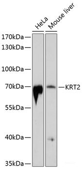 Immunohistochemistry of paraffin-embedded Rat lung using HO-1 Polyclonal Antibody at dilution of 1:200 (40x lens).