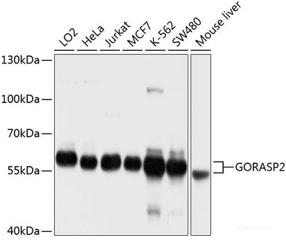 Immunofluorescence analysis of L929 cells using CYR61 Polyclonal Antibody at dilution of 1:100. Blue: DAPI for nuclear staining.
