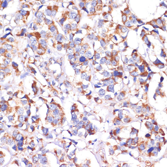 Western blot analysis of extracts of Mouse liver using IL1 beta Polyclonal Antibody at dilution of 1:1000.