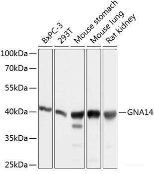 Immunohistochemistry of paraffin-embedded Rat testis using VEGF Receptor 2 Polyclonal Antibody at dilution of 1:100 (40x lens).