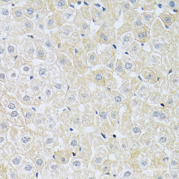 Immunohistochemistry of paraffin-embedded Mouse kidney using MMP9 Polyclonal Antibody at dilution of 1:100 (40x lens).