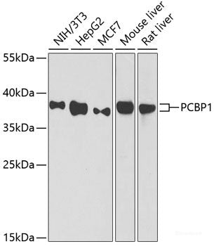 Immunohistochemistry of paraffin-embedded Mouse leydig cells using NRF2 Polyclonal Antibody at dilution of 1:100 (40x lens).