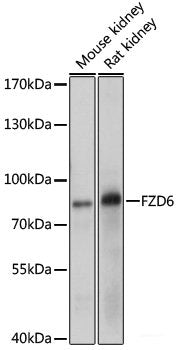 Immunohistochemistry of paraffin-embedded Mouse lung using TTR Polyclonal Antibody at dilution of 1:100 (40x lens).