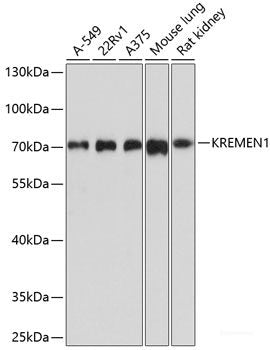 Immunohistochemistry of paraffin-embedded Human placenta using STAT3 Polyclonal Antibody at dilution of 1:200 (40x lens).