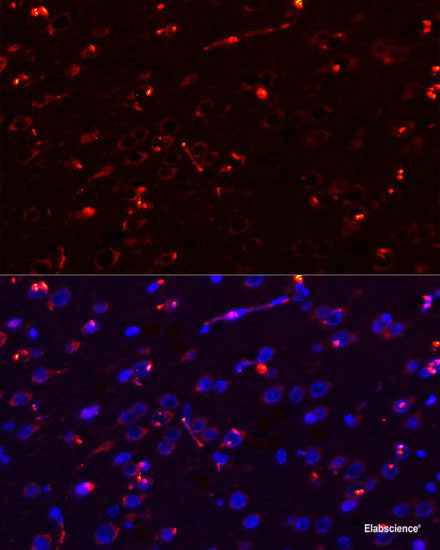 Western blot analysis of extracts of Human brain using CRH Polyclonal Antibody.