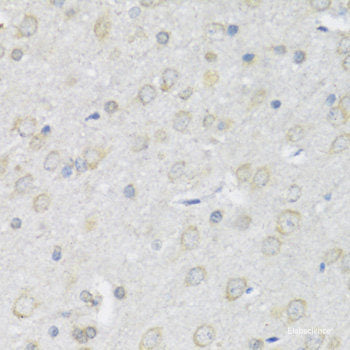 Immunohistochemistry of paraffin-embedded Human appendix using TLR4 Polyclonal Antibody at dilution of 1:100 (40x lens).