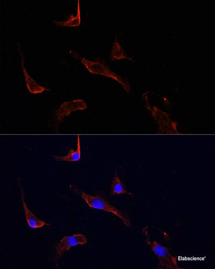Immunohistochemistry of paraffin-embedded Rat lung using PHPT1 Polyclonal Antibody at dilution of 1:100 (40x lens).