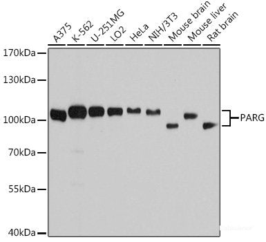Western blot analysis of extracts of HCT116 cells using Cyclin D1 Polyclonal Antibody at dilution of 1:1000. HCT116 cells treated with different concentRations of RSPO1.