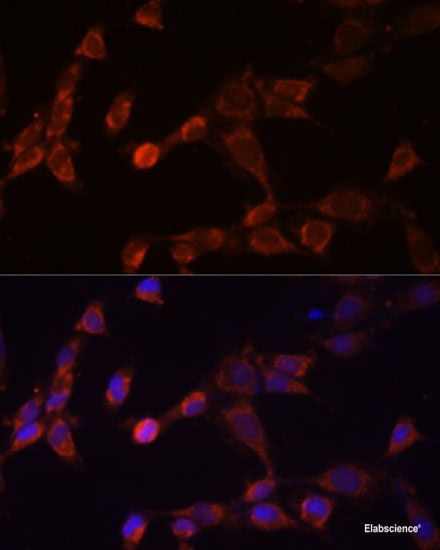 Immunohistochemistry of paraffin-embedded Mouse liver using MYC Polyclonal Antibody at dilution of 1:100 (40x lens).