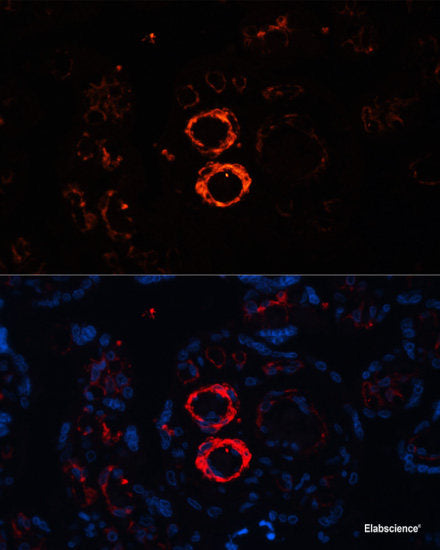 Immunohistochemistry of paraffin-embedded Rat kidney using ASC / TMS1 Polyclonal Antibody at dilution of 1:100 (40x lens).