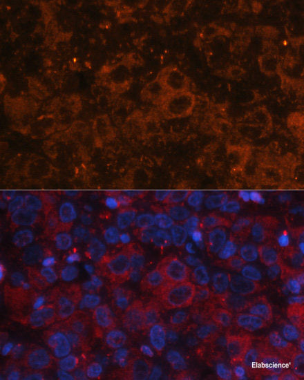Western blot analysis of extracts of various cell lines using RRM1 Polyclonal Antibody at dilution of 1:1000.