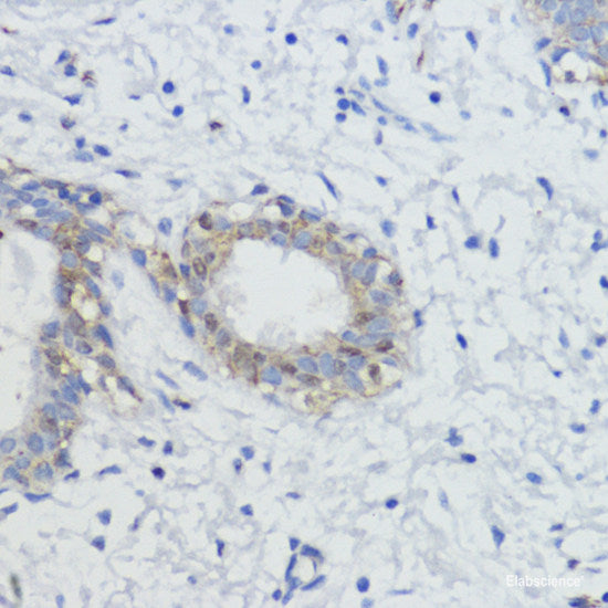 Immunohistochemistry of paraffin-embedded Mouse heart using MMP9 Polyclonal Antibody at dilution of 1:100 (40x lens).