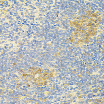 Immunohistochemistry of paraffin-embedded Rat lung using MTCO2 Polyclonal Antibody at dilution of 1:100 (40x lens).