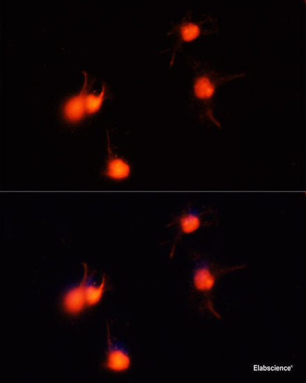 Immunohistochemistry of paraffin-embedded Human stomach using TNF-α Polyclonal Antibody at dilution of 1:100 (40x lens).