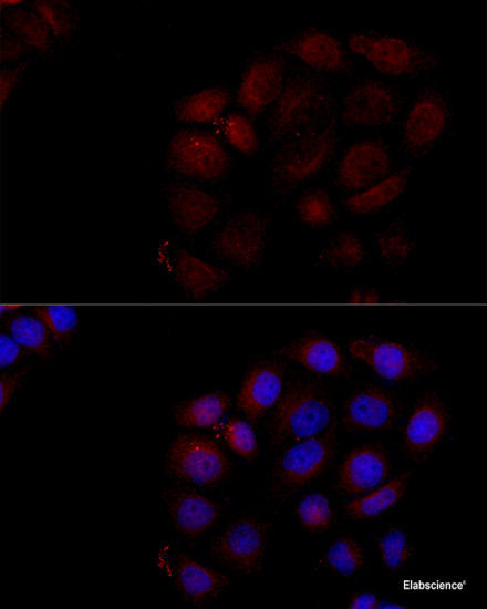 Immunohistochemistry of paraffin-embedded Rat liver using CHD4 Polyclonal Antibody at dilution of 1:100 (40x lens).