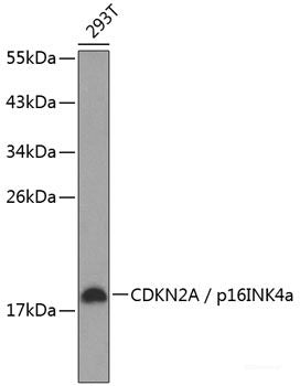 Immunohistochemistry of paraffin-embedded Human lung cancer using EGFR Polyclonal Antibody at dilution of 1:100 (40x lens).