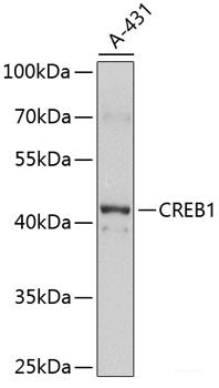 Western blot analysis of extracts of OVCAR3 cells using EGFR Polyclonal Antibody at dilution of 1:3000.