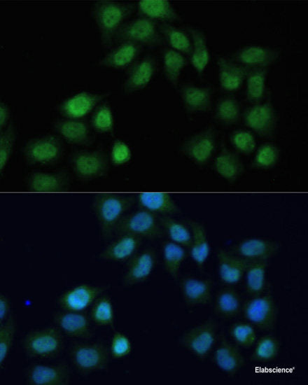 Immunohistochemistry of paraffin-embedded Human stomach using BCL2L2 Polyclonal Antibody at dilution of 1:100 (40x lens).