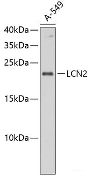 Confocal immunofluorescence analysis of U2OS cells using OCIAD1 Polyclonal Antibody at dilution of 1:100. Blue: DAPI for nuclear staining.