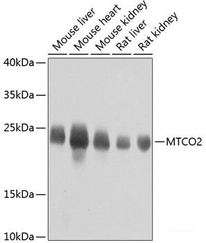 Immunofluorescence analysis of H9C2 cells using OTUB1 Polyclonal Antibody at dilution of 1:100. Blue: DAPI for nuclear staining.