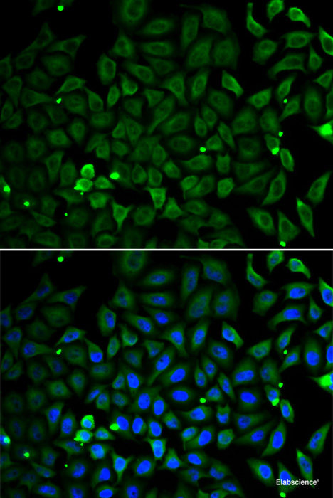 Western blot analysis of extracts of various cell lines using SLC25A12 Polyclonal Antibody at dilution of 1:3000.