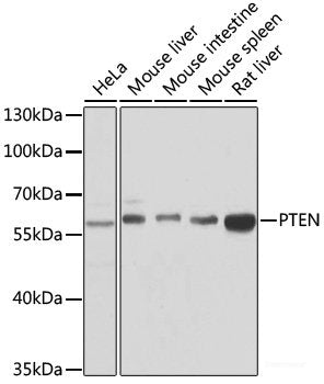 Western blot analysis of extracts of various cell lines using ASC / TMS1 Polyclonal Antibody.