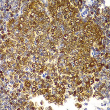 Immunohistochemistry of paraffin-embedded Mouse heart using CAPN1 Polyclonal Antibody at dilution of 1:100 (40x lens).