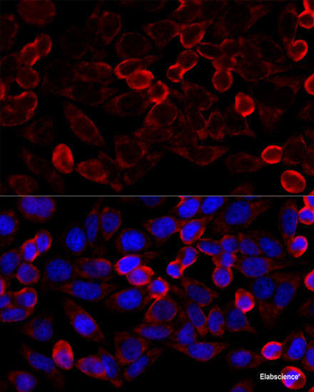 Immunohistochemistry of paraffin-embedded Rat liver using TRIM15 Polyclonal Antibody at dilution of 1:100 (40x lens).